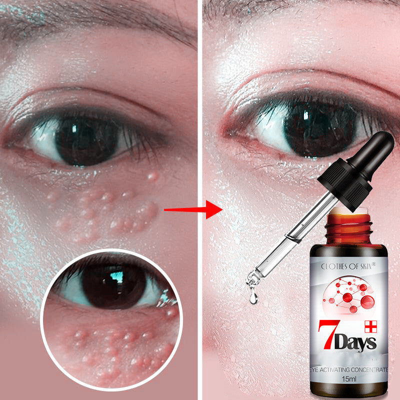 Skin Clothing Direct Eye Rejuvenating Liquid to Reduce Dark Circles